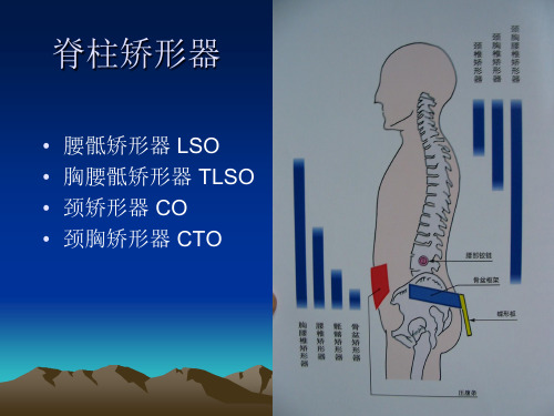 【医学课件】脊柱矫形器