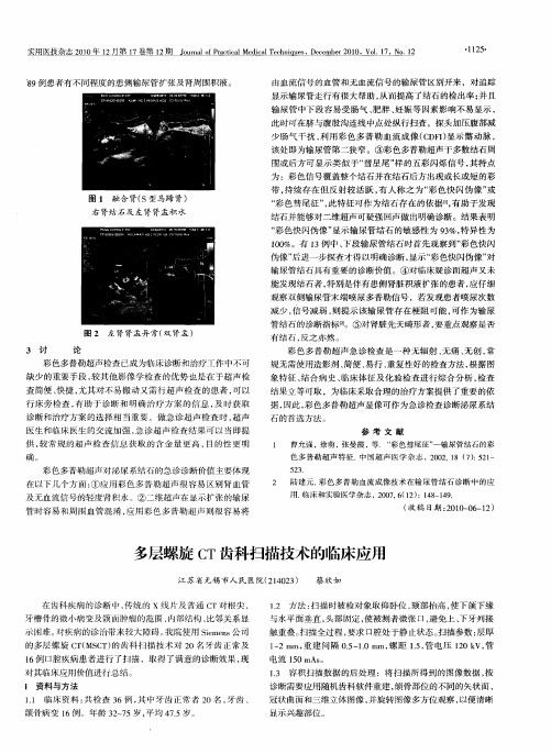 多层螺旋CT齿科扫描技术的临床应用