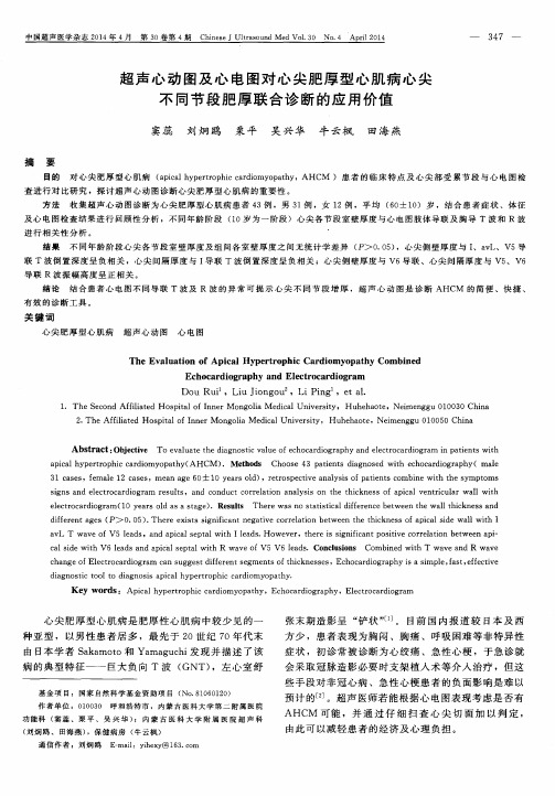 超声心动图及心电图对心尖肥厚型心肌病心尖不同节段肥厚联合诊断的应用价值