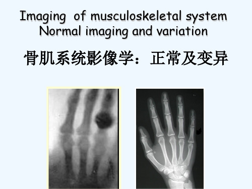 骨肌系统影像英文 PPT