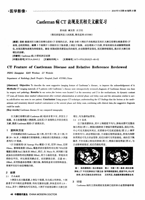 Castleman病CT表现及其相关文献复习
