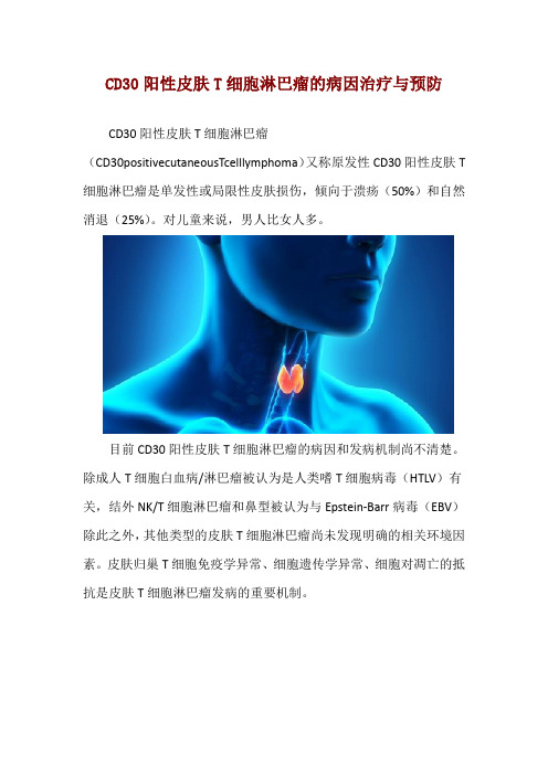 CD30阳性皮肤T细胞淋巴瘤的病因治疗与预防