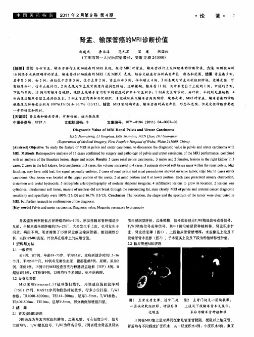 肾盂、输尿管癌的MRI诊断价值