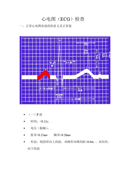 心电图知识