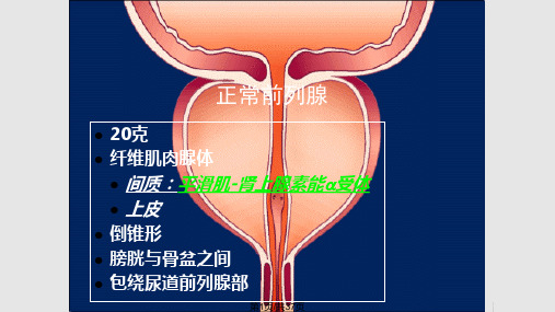 整理良性前列腺增生诊疗指南PPT课件