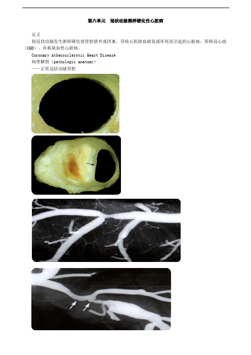 医学课件---第六单元 冠状动脉粥样硬化性心脏病