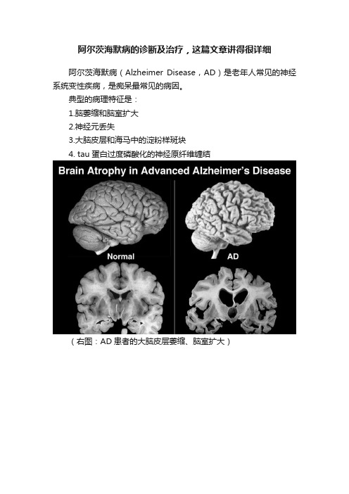 ?阿尔茨海默病的诊断及治疗，这篇文章讲得很详细