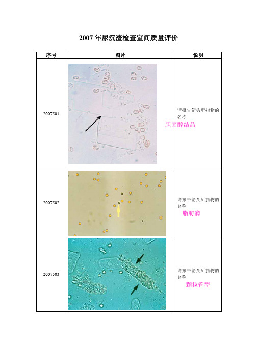 汇总卫生部 2007-17年合并尿沉渣检查室间质量评价(附整理答案)