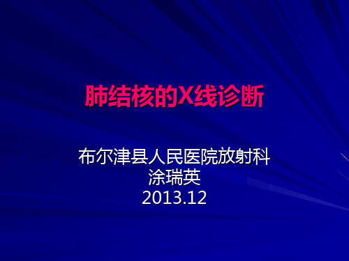 肺结核的X线及CT诊断 共51页