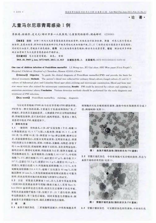 儿童马尔尼菲青霉感染1例