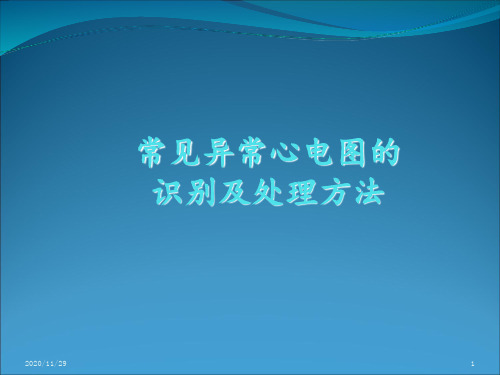 常见异常心电图的识别及处理 ppt课件