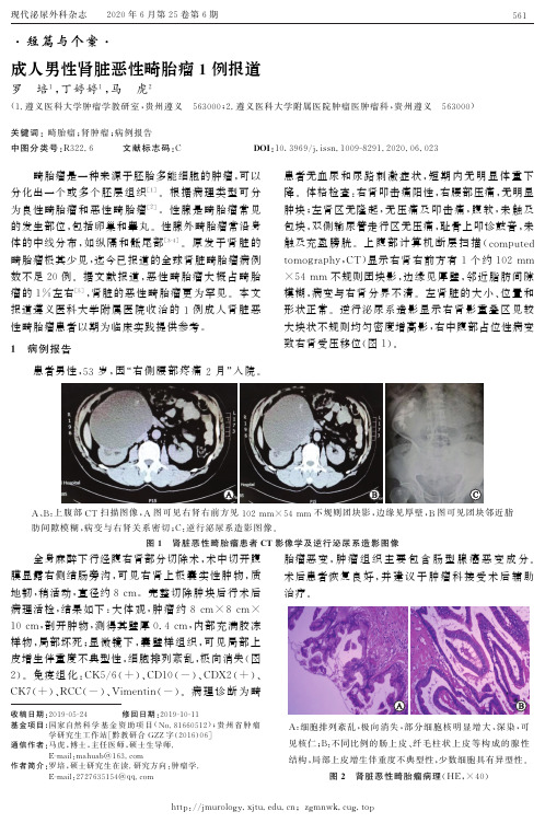 成人男性肾脏恶性畸胎瘤1例报道