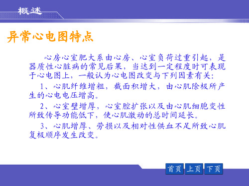 异常心电图 PPT课件