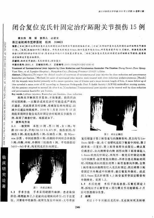 闭合复位克氏针固定治疗跖附关节损伤15例