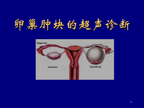 卵巢肿块的超声诊断ppt课件