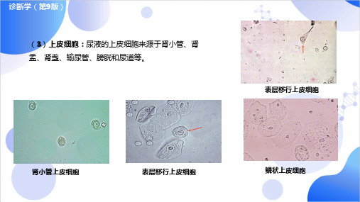 第九版诊断学精品课件排泄物、分泌物及体液检测{二}