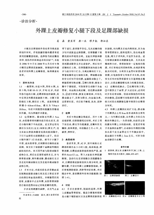 外踝上皮瓣修复小腿下段及足踝部缺损