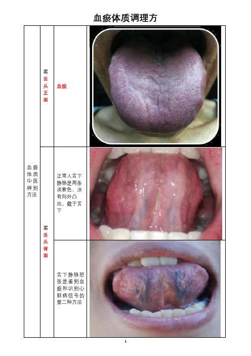 血瘀体质调理方