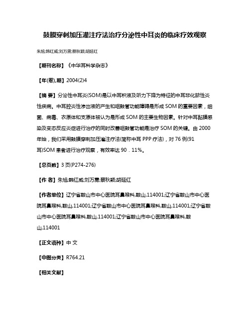 鼓膜穿刺加压灌注疗法治疗分泌性中耳炎的临床疗效观察