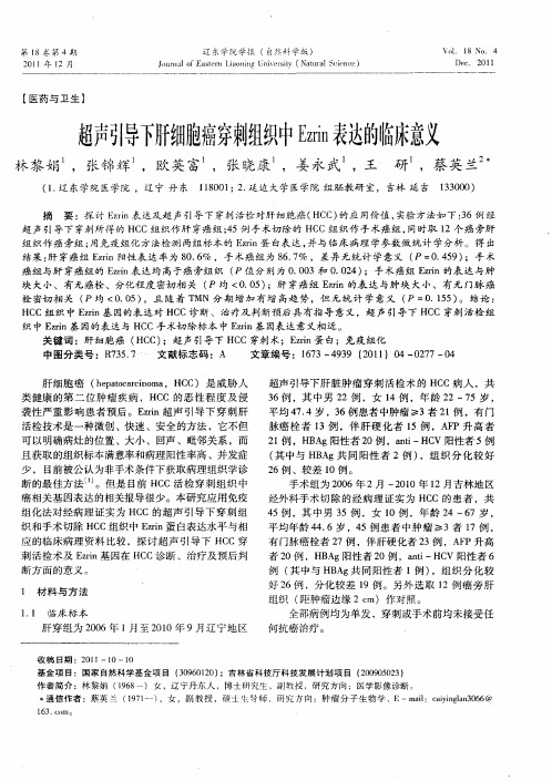 超声引导下肝细胞癌穿刺组织中Ezrin表达的临床意义