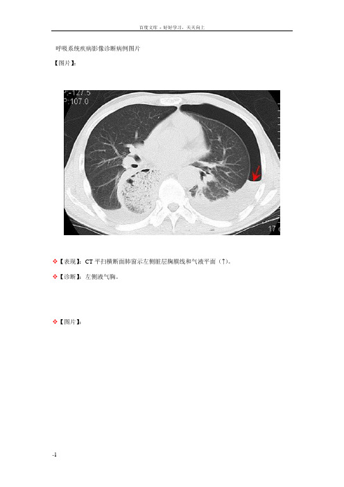 呼吸系统疾病影诊断病例图片