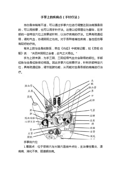 手掌上的疾病点（手针疗法）