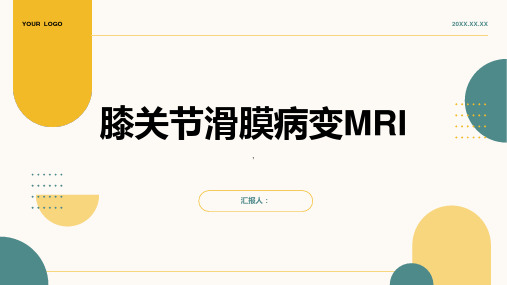 膝关节滑膜病变MRI