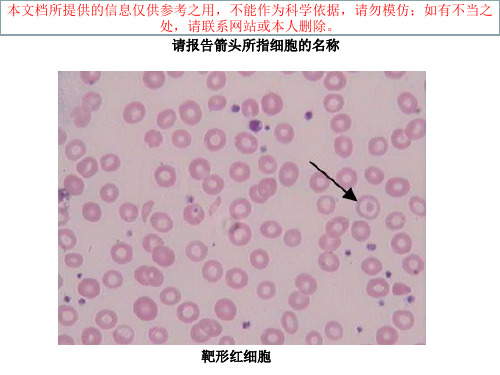 血涂片图谱专题知识讲座培训课件