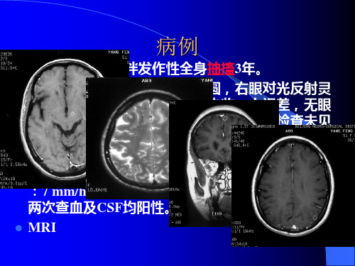 囊虫病ppt课件