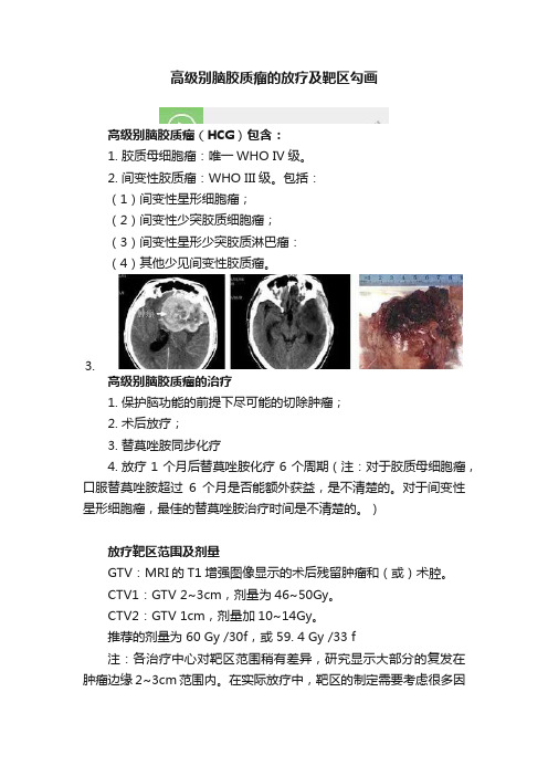 高级别脑胶质瘤的放疗及靶区勾画