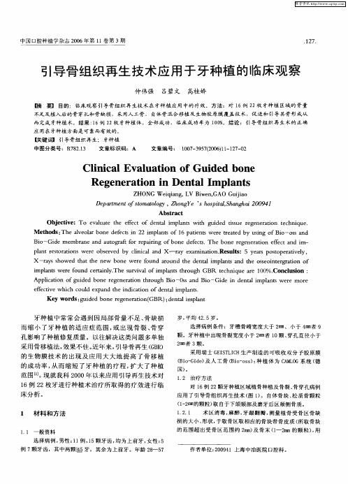 引导骨组织再生技术应用于牙种植的临床观察