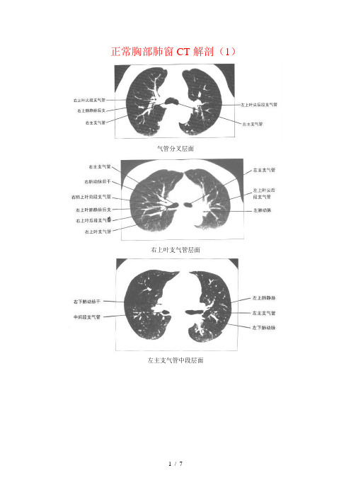 正常胸部CT解剖(肺窗和纵隔窗)