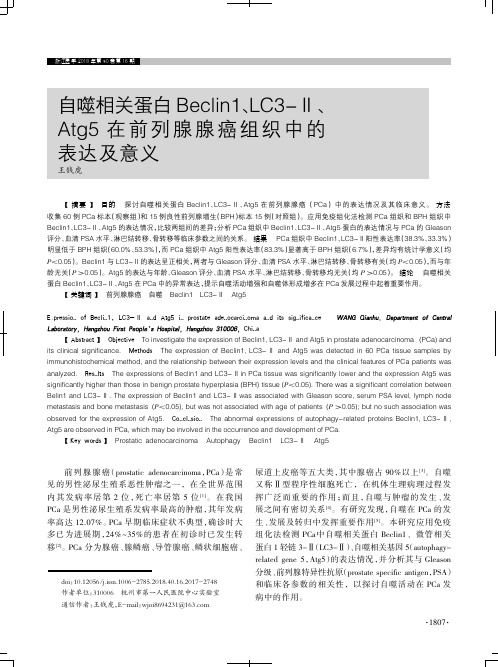 自噬相关蛋白Beclin1、LC3-Ⅱ、Atg5在前列腺腺癌组织中的表达及意义