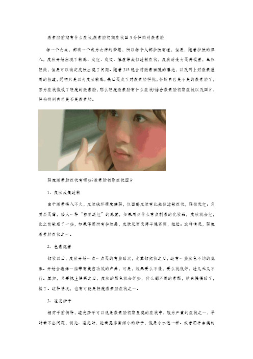 轻度激素脸有什么症状,激素脸早期症状图3分钟辨别激素脸