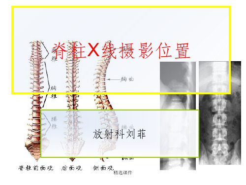 脊柱X线摄影技术ppt课件