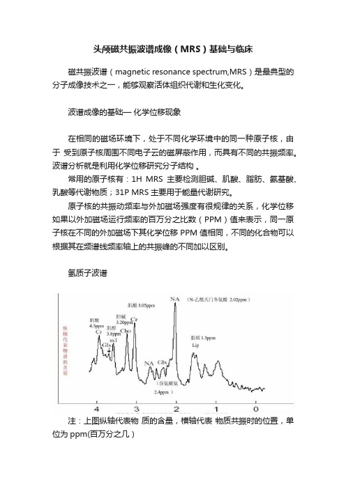 头颅磁共振波谱成像（MRS）基础与临床