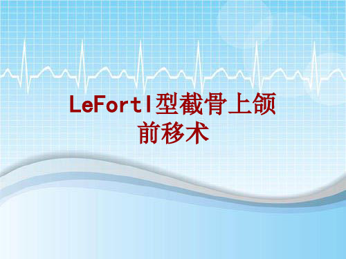 手术讲解模板：LeFortI型截骨上颌前移术