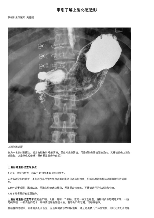 带您了解上消化道造影