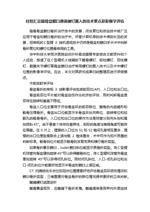 经验汇总篇骨盆髋臼通道螺钉置入的技术要点及影像学评估