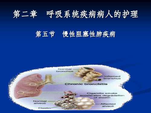 【学习】第二章慢性阻塞性肺疾病