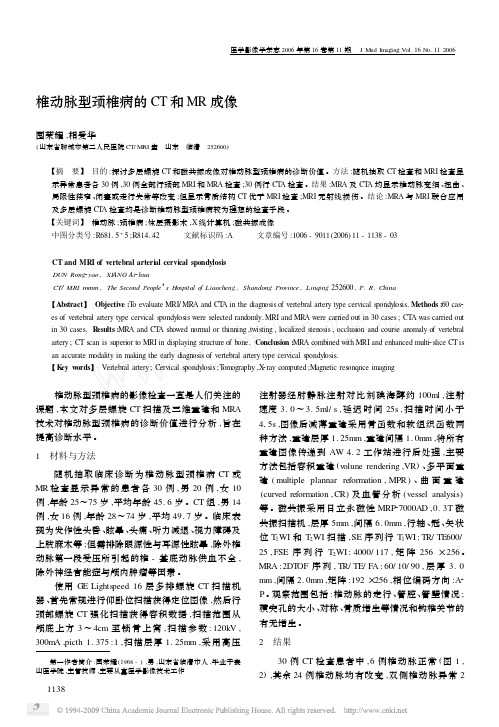 椎动脉型颈椎病的CT和MR成像[1]