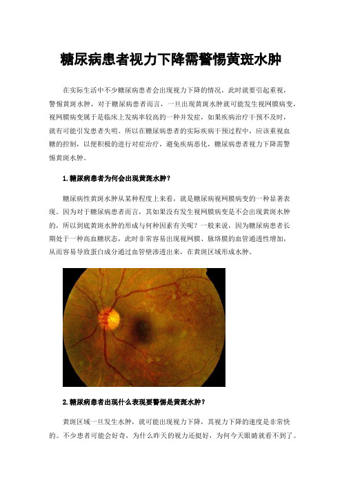 糖尿病患者视力下降需警惕黄斑水肿