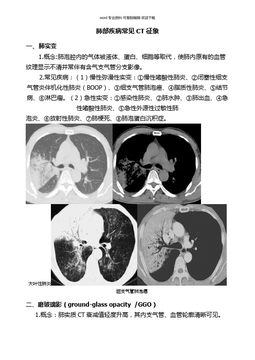 肺部疾病CT征象