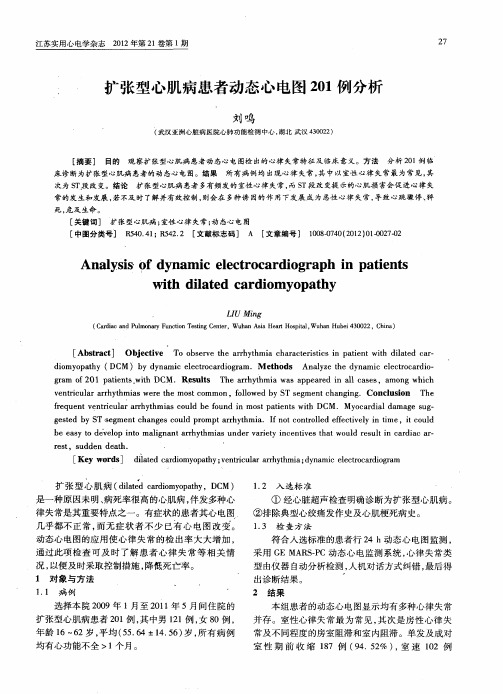 扩张型心肌病患者动态心电图201例分析