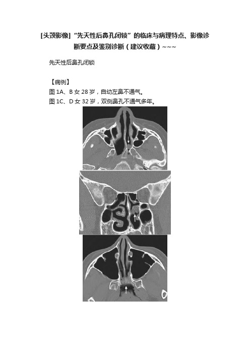 [头颈影像]“先天性后鼻孔闭锁”的临床与病理特点、影像诊断要点及鉴别诊断（建议收藏）~~~