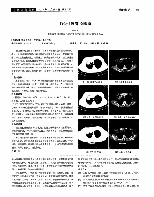 肺炎性假瘤1例报道