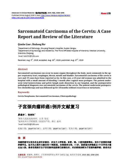 子宫颈肉瘤样癌1例并文献复习