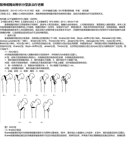 股骨粗隆间骨折分型及治疗进展