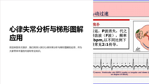 心律失常分析与梯形图解应用