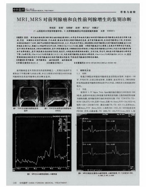 MRI、MRS对前列腺癌和良性前列腺增生的鉴别诊断